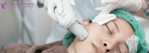Ultherapy Facelift - Dr.Rajan Tajhya | Aakar Dermatology