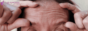 Wrinkle Reduction - Dr.Rajan Tajhya | Aakar Dermatology