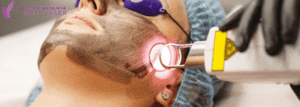 black doll laser - Dr.Rajan Tajhya | Aakar Dermatology