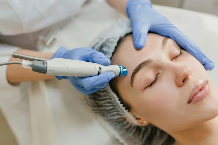 Laser Facial Treatment